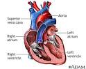 Heart palpitations - Franciscan St. Margaret Health | Northwest ...