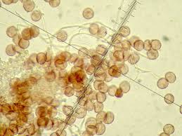 Attēlu rezultāti vaicājumam “Diderma testaceum spores”