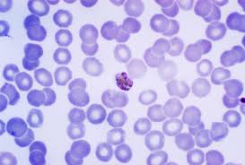 Attēlu rezultāti vaicājumam “Cribraria purpurea plasmodium”