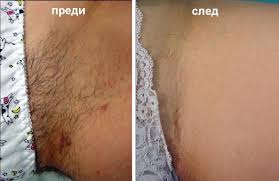 http://t0.gstatic.com/images?q=tbn:ANd9GcQSE-sH7D0xMBUSm4v7P5iHMLcYQ2vWCxyQ9iyVh7uRy1bLpUj_0w