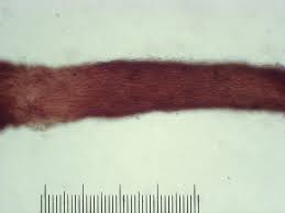 Attēlu rezultāti vaicājumam “Melanospora lagenaria”