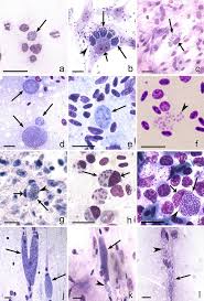 Attēlu rezultāti vaicājumam “undetermined plasmodium”