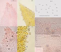 Attēlu rezultāti vaicājumam “Mucronella calva”