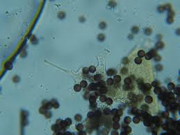 Attēlu rezultāti vaicājumam “Physarum bryocorticola macro”