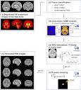 A Fetal Brain magnetic resonance Acquisition Numerical phantom ...