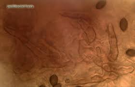 Attēlu rezultāti vaicājumam “Melanospora lagenaria”