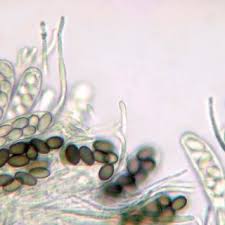 Attēlu rezultāti vaicājumam “Ascobolus furfuraceus”