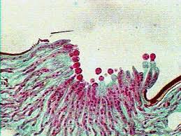 Attēlu rezultāti vaicājumam “Entomophthora”