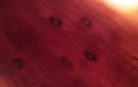 Attēlu rezultāti vaicājumam “Octosporella jungermanniarum”