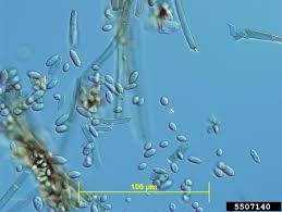Attēlu rezultāti vaicājumam “Clastoderma debaryanum spores”