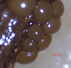 Attēlu rezultāti vaicājumam “Perichaena corticalis macro”