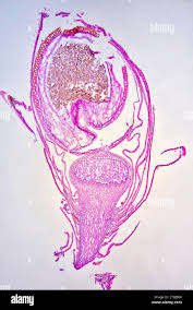 Attēlu rezultāti vaicājumam “Sphagnum centrale sporophyte”
