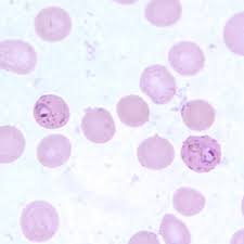 Attēlu rezultāti vaicājumam “undetermined plasmodium”