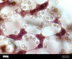 Attēlu rezultāti vaicājumam “Cribraria vulgaris”