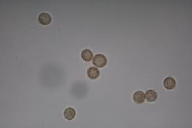 Attēlu rezultāti vaicājumam “Tubifera applanata spores”