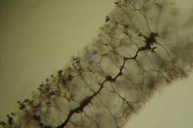 Attēlu rezultāti vaicājumam “Stemonitopsis aequalis var. microspora spores”