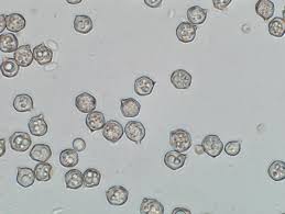 Attēlu rezultāti vaicājumam “Diderma montanum var. album spores”