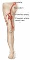 The <b>femoral artery</b> is located