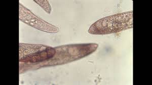 Attēlu rezultāti vaicājumam “Blepharostoma trichophyllum sporophyte”