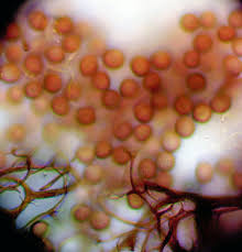 Attēlu rezultāti vaicājumam “Stemonitopsis aequalis var. microspora stalked”