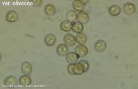 Attēlu rezultāti vaicājumam “Trichia crateriformis spores”