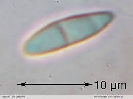 Attēlu rezultāti vaicājumam “Coenogonium pineti”