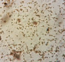 Attēlu rezultāti vaicājumam “Cribraria cancellata spores”