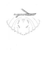 Attēlu rezultāti vaicājumam “Chionaspis salicis”