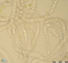 Attēlu rezultāti vaicājumam “Nitella flexilis”