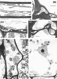 Attēlu rezultāti vaicājumam “Harpanthus flotovianus cells”