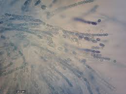 Attēlu rezultāti vaicājumam “Hypocrea pulvinata”