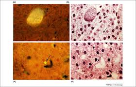 Attēlu rezultāti vaicājumam “Enteridium olivaceum plasmodium”