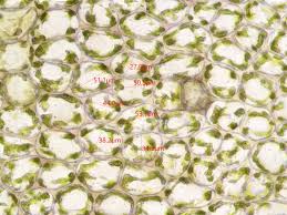 Attēlu rezultāti vaicājumam “Jungermannia hyalina cells”