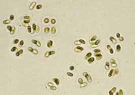Attēlu rezultāti vaicājumam “Gloeocapsa rupestris”