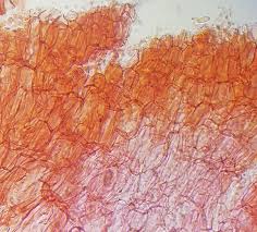 Attēlu rezultāti vaicājumam “Ombrophila violacea spores”