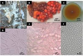 Attēlu rezultāti vaicājumam “Neonectria fuckeliana”