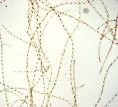 Attēlu rezultāti vaicājumam “Trentepohlia sp.”