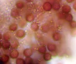 Attēlu rezultāti vaicājumam “Badhamia flavoglauca spores”