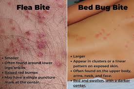 Image result for bed bug bites
