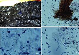Attēlu rezultāti vaicājumam “Didymium bahiense”