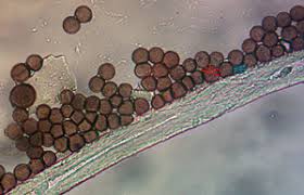Attēlu rezultāti vaicājumam “Badhamia flavoglauca”