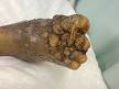 Madura Foot