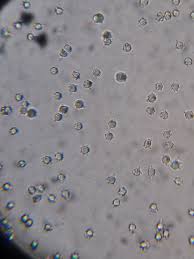 Attēlu rezultāti vaicājumam “Clavulinopsis helvola”