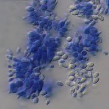 Attēlu rezultāti vaicājumam “Cordyceps farinosa”