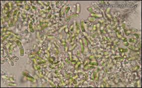 Attēlu rezultāti vaicājumam “Chaenotheca chlorella”