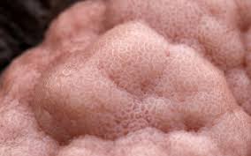 Attēlu rezultāti vaicājumam “Amaurochaete atra”