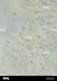 Attēlu rezultāti vaicājumam “Trechispora mollusca”