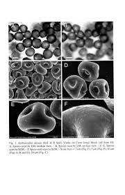 Attēlu rezultāti vaicājumam “Anthracoidea”