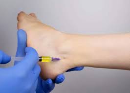 Image result for BMAC