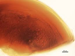 Attēlu rezultāti vaicājumam “Physarum decipiens spores”